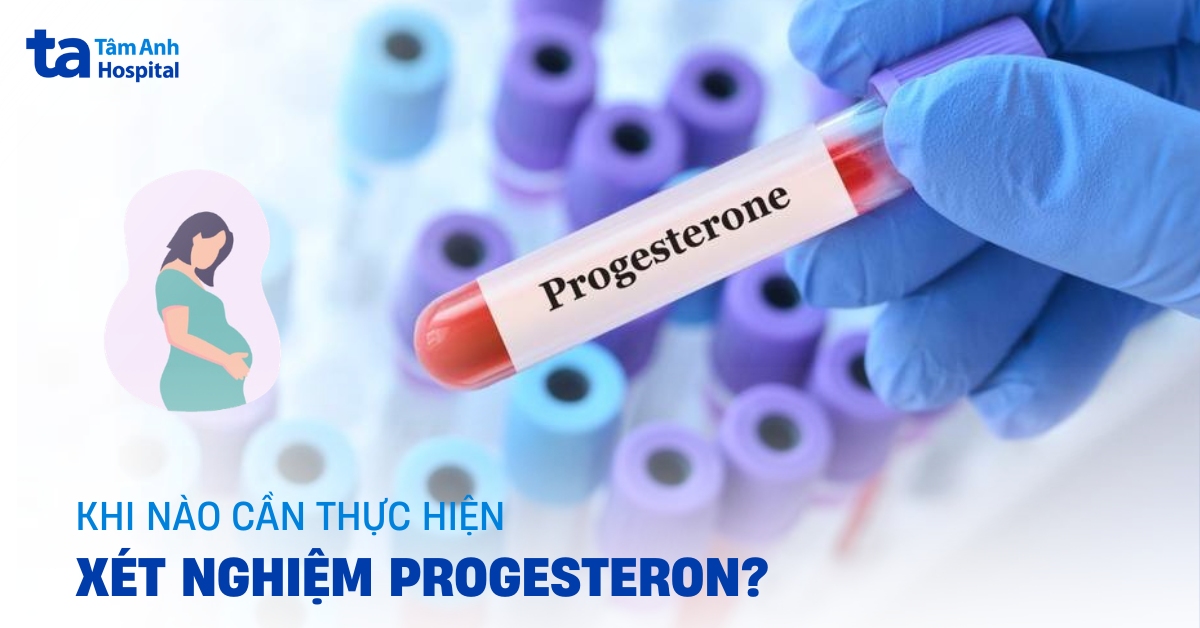 Xét nghiệm Progesterone khi nào được chỉ định? Cách đọc kết quả