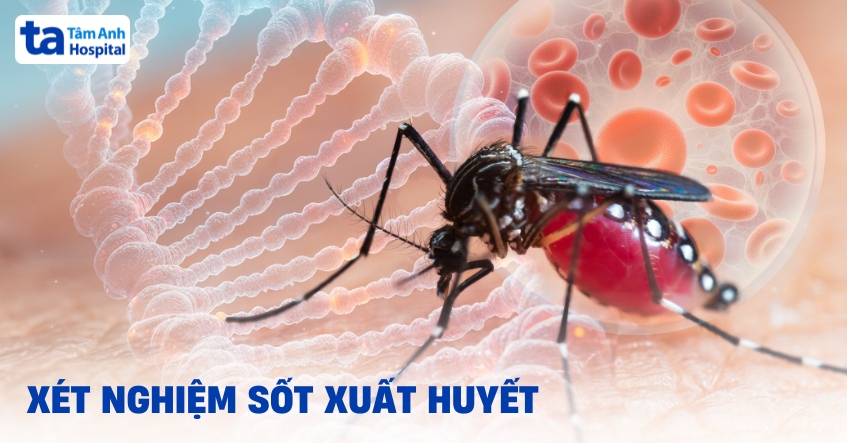 3 xét nghiệm sốt xuất huyết giúp chẩn đoán chính xác bệnh