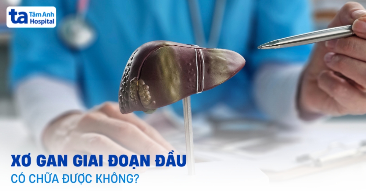 Xơ Gan Giai Đoạn Đầu