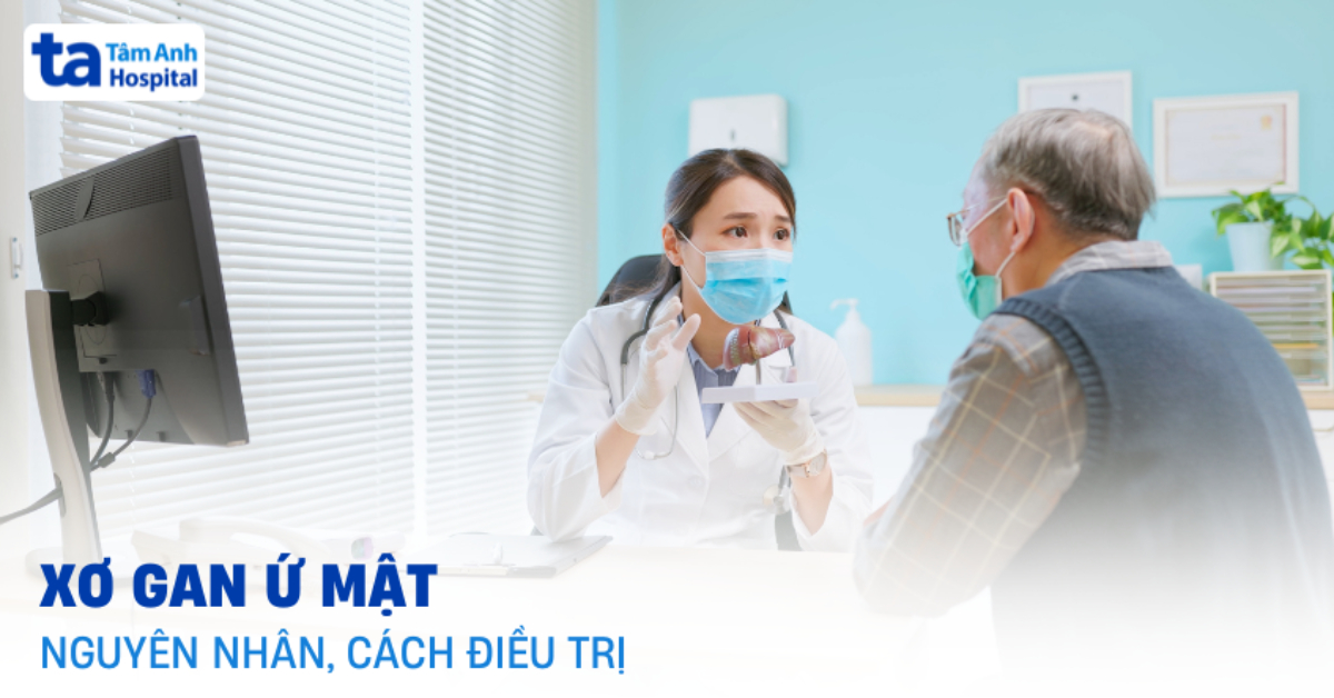 Xơ gan ứ mật do đâu? Hướng điều trị khoa học