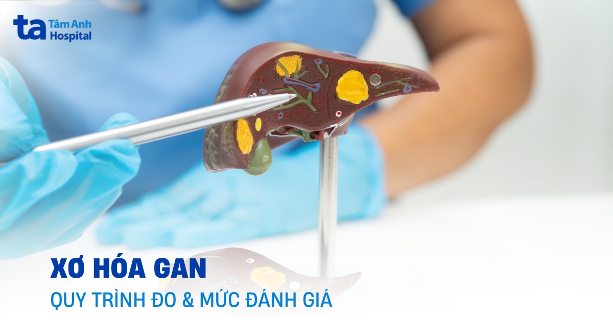Xơ hóa gan và quy trình đánh giá mức độ