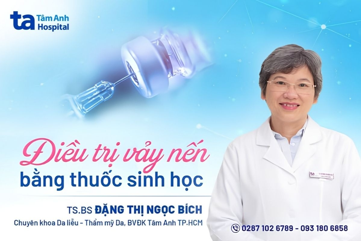 ý nghĩa ngày vảy nến thế giới